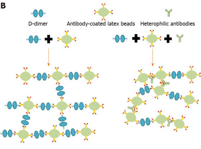 the latex agglutination assay uses latex beads coated with a D-dimer-specific antibody