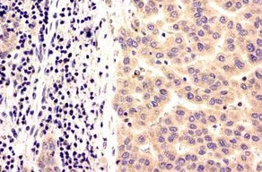 Immunohistochemical staining (immunohistochemistry)