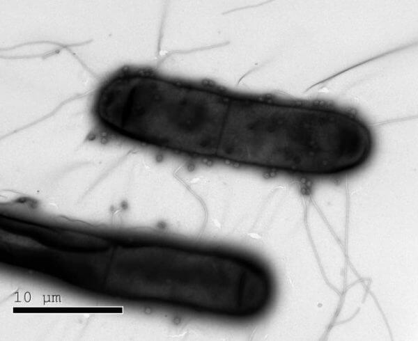 CRISPR's-Comrades-in-Arms-Discovered-in-Microbial-Genomes.jpg