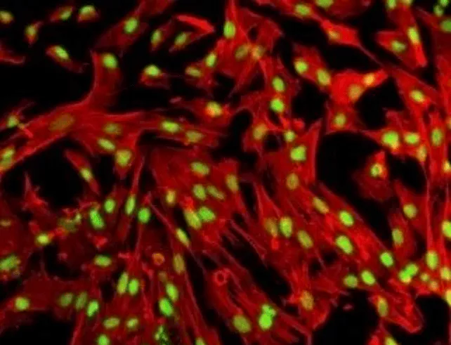 Fluorescein FITC-labeled antibody method