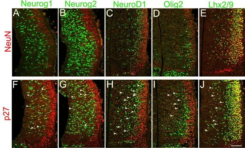 Silencing Neuroplastin Gene Erases Pavlovian Memory