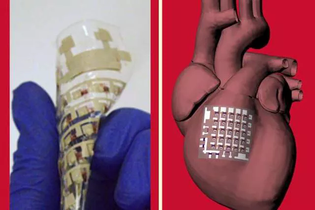 Cyborg Cardiac Patch May Treat The Damaged Heart