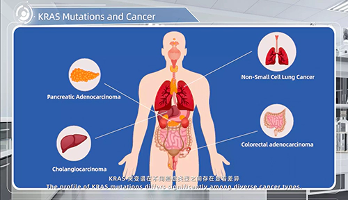 KRAS Mutations and Cancer.webp