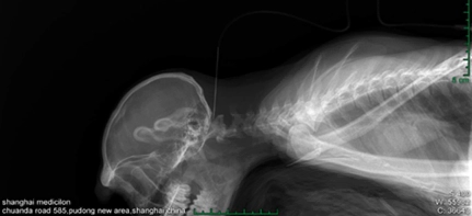 Intracerebroventricular administration in monkeys.webp