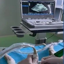 Medicilon Liver Biopsy Guided By B-ultrasound In Cynomolgus Monkeys Platform.webp