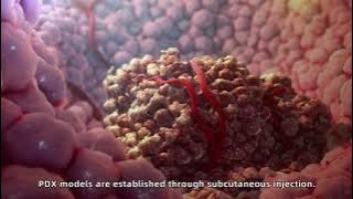 Patient-Derived Xenograft Models (PDX) for Preclinical Research 