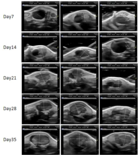 Orthotopic Bladder Cancer PDXM-237U.webp