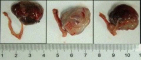   3. Orthotopic Ovarian Cancer PDXM-271O.webp