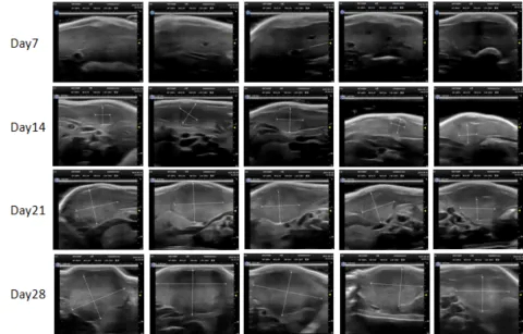 Pic 2 of Orthotopic Liver Cancer PDXM-212Li.webp