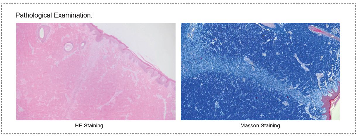 Analgesic Test of Compound Preparation on Postoperative Acute Pain Model in Bama Miniature Pigs-2.webp