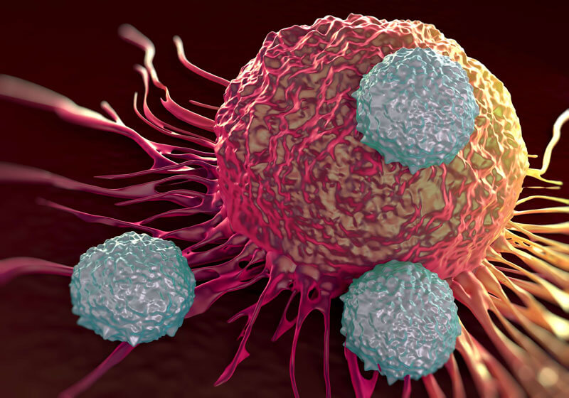 CAR T Cells More Powerful When Built With CRISPR