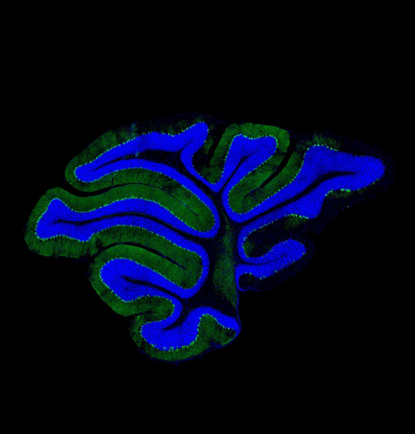 Protein Trafficking Roadblocks Could Be Cause of Neurodegeneration