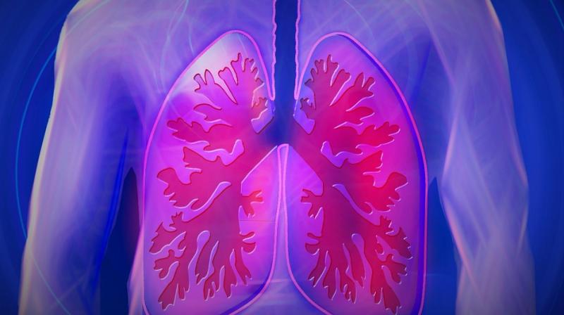 Discovery May Help Patients Beat Deadly Pneumonia