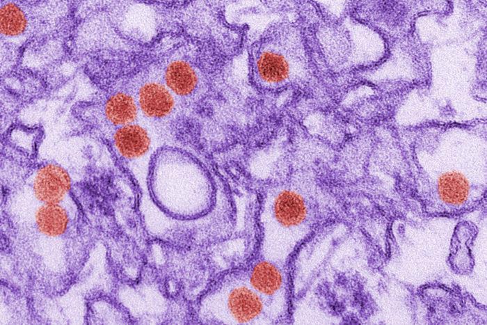 New Therapeutic Targets Identified in Zika-Infected Brain Cells