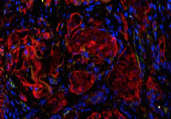 Tissue Engineering Opens Door to Novel Type 1 Diabetes Therapy