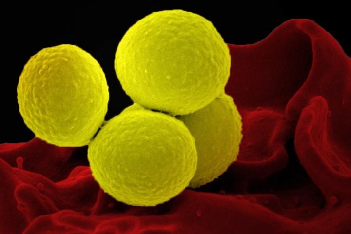 Microbial Vampires Shrink from Light