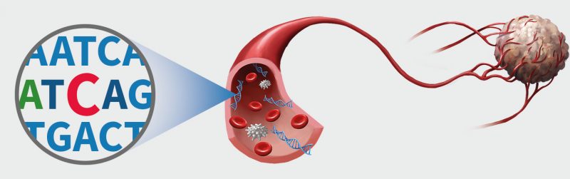 Liquid Biopsy Reads RNA Collected by Platelets to Diagnose Cancer