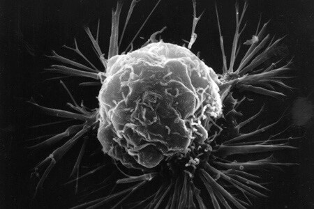 Advanced Nanodot System Improves Tumor Visualization