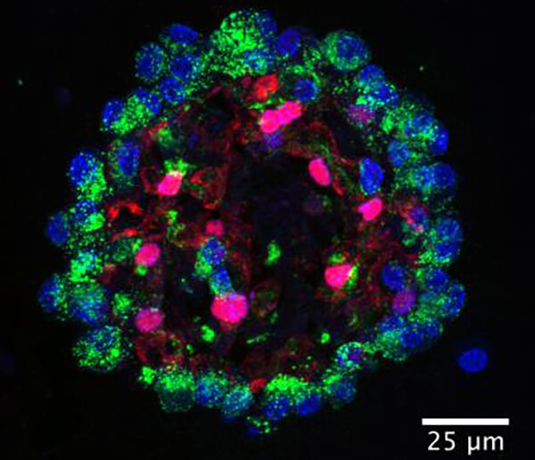 Lung Cell Lineage Mapping May Reveal Lung Renewal Strategies