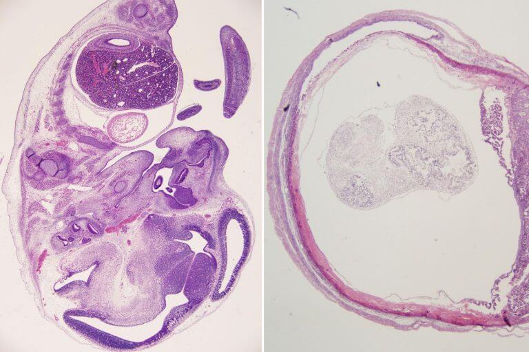 Human Dengue Virus Antibodies Protect Mice and Unborn Pups from Zika Virus