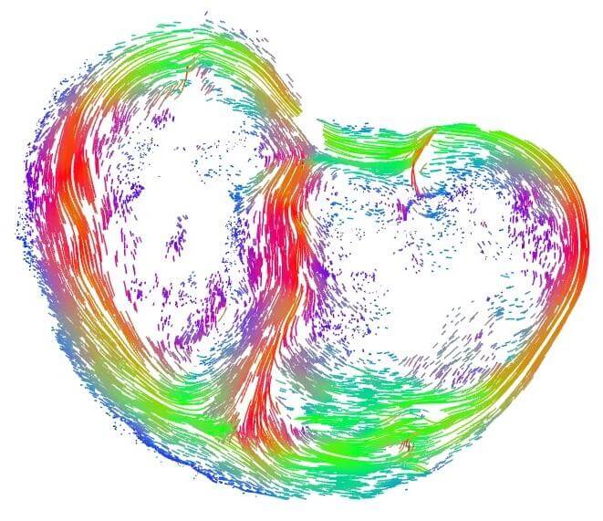 Critical Moment of Fetal Heart Development Identified