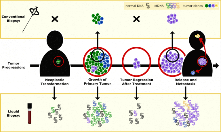 Immunotherapy Response Predicted by Liquid Biopsy