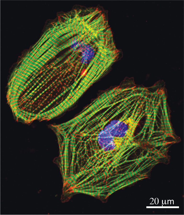 Novel RNA Switch Dramatically Boosts Expression