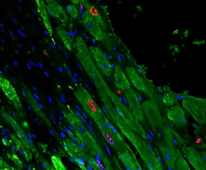 microRNA Gel Helps Damaged Hearts Get to a Better Beat