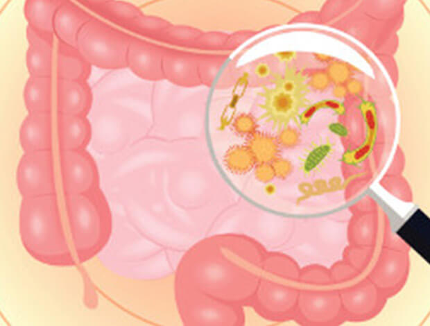 Gut Microbiome Promotes Pancreatic Cancer Progression