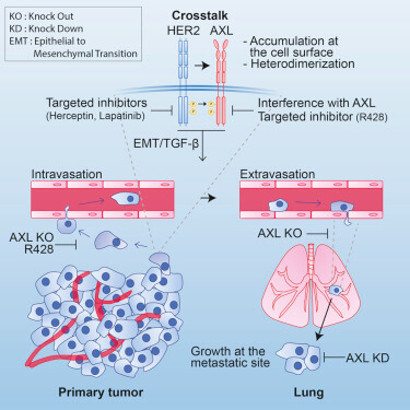 Protein in Breast Cancer Found to Be Essential for Metastasis