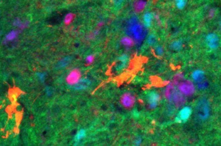 Breathing Paralysis Improved through Transplantation of Lab-Grown Neurons