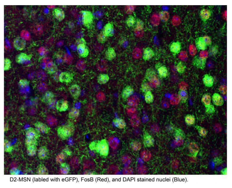 Addicted to Aggression? Brain Protein May Hold the Answer