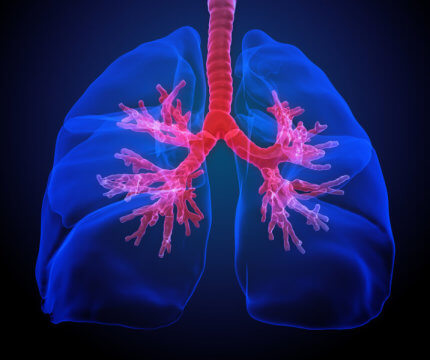 Rare Lung Cell Type Appears to Play Important Role in Cystic Fibrosis