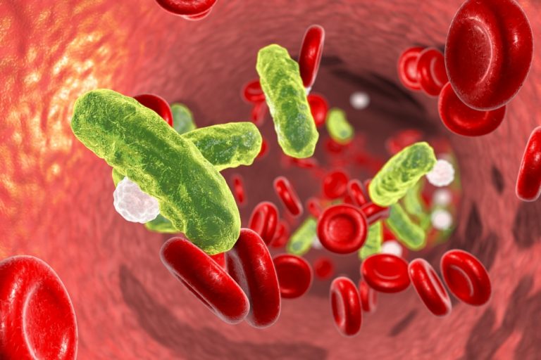 Tracking Molecular Development of Sepsis May Lead to Improved Therapies