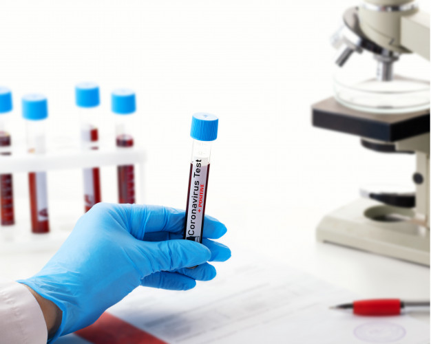 Analysis of Three Verification Methods of Biological Sample Analysis