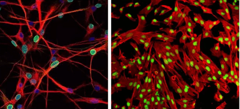 Direct Fluorescent Antibody Test