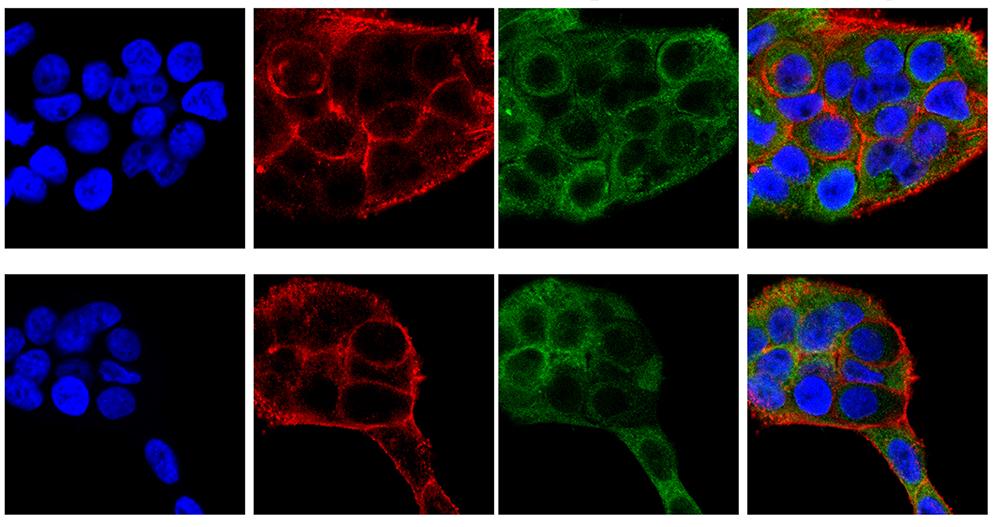 Indirect immunofluorescence method for antibody detection